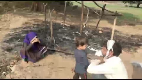 सिल्लारपुर में आग से झुलसी 3 साल की मासूम बच्ची की मौत, SP ने बताया हादासा, जांच जारी